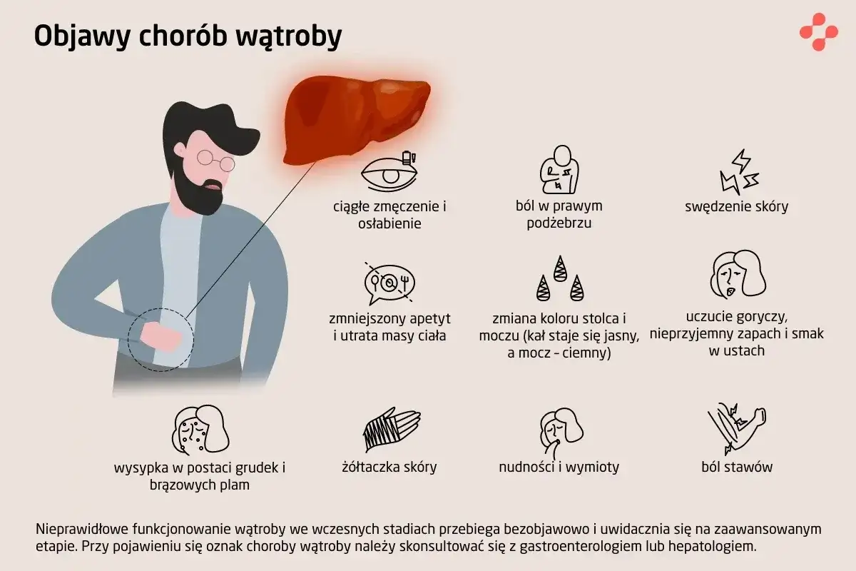 Ilustracja przedstawia objawy chorób wątroby, w tym zmęczenie, ból brzucha, swędzenie skóry, nudności, żółtaczkę, a także zmiany w kolorze moczu i stolca. Wzw c może objawiać się podobnymi symptomami.