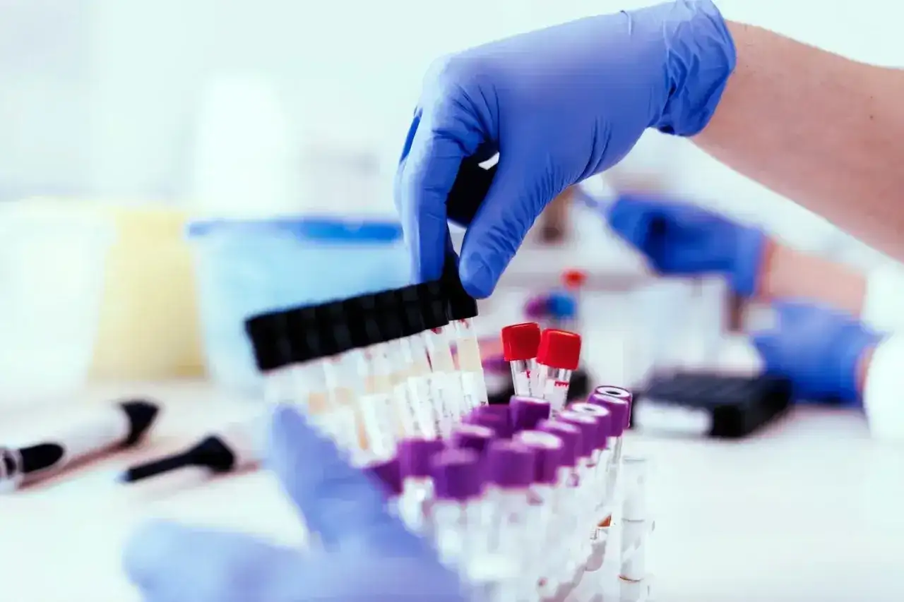 Ręce w niebieskich rękawiczkach przygotowują probówki do analizy. To ważny etap w procesie, jakim jest test na narkotyki.