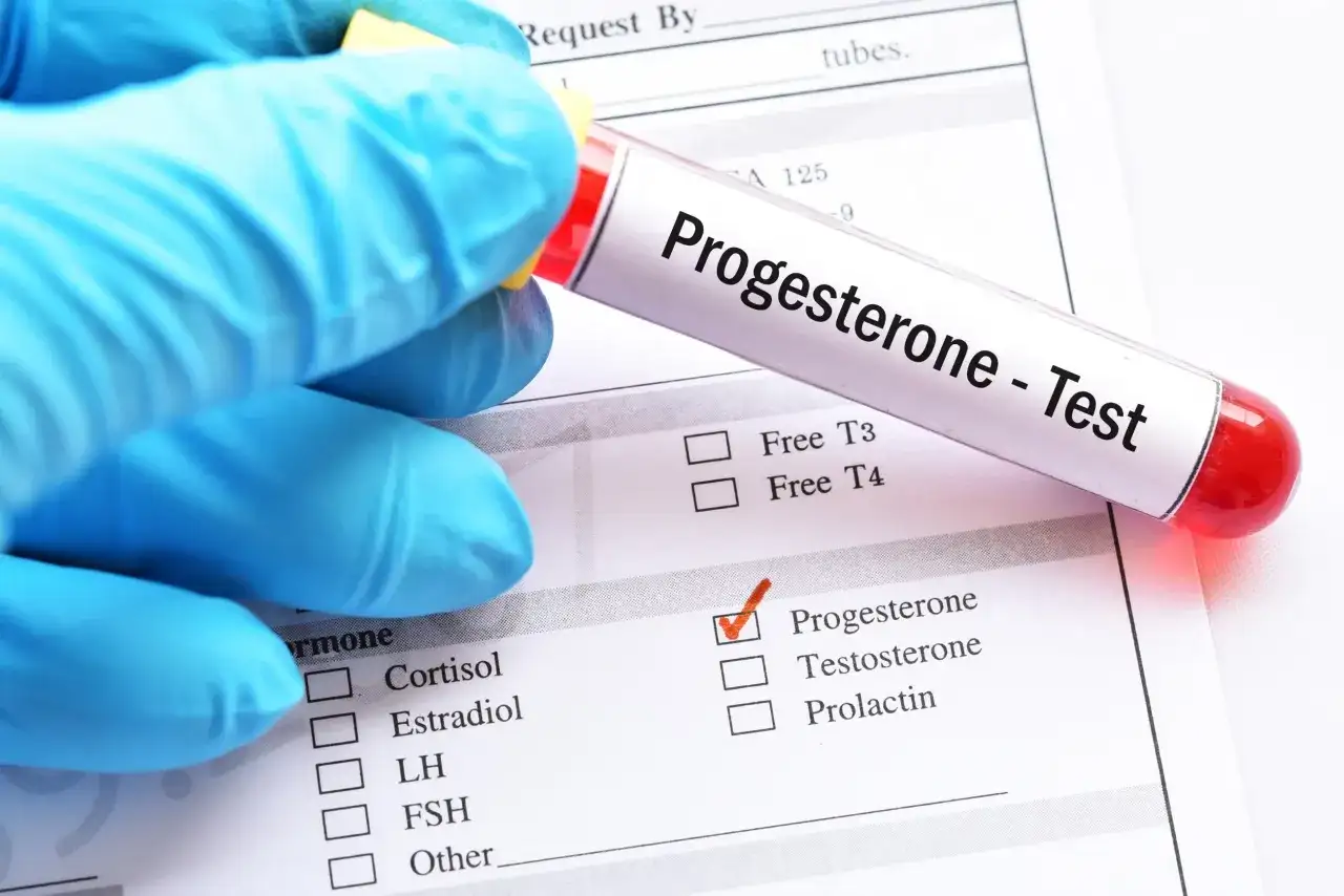 Rękawiczka w niebieskiej rękawiczce trzyma probówkę z napisem "Progesterone - Test". Zaznaczono pole "Progesterone" na formularzu.