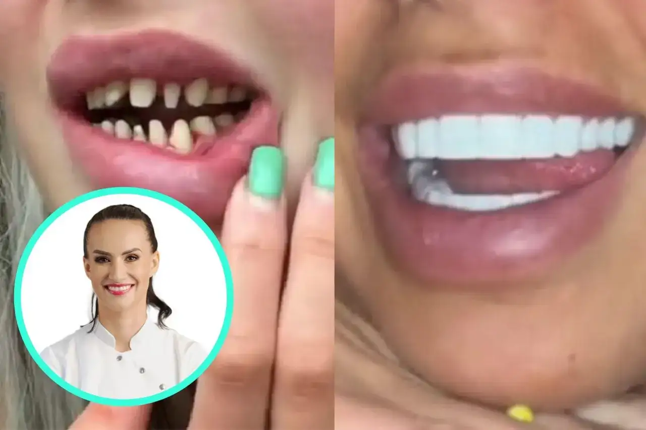 Przed i po: nieudane tureckie zęby, powikłania po zabiegu, a obok uśmiechnięta dentystka.