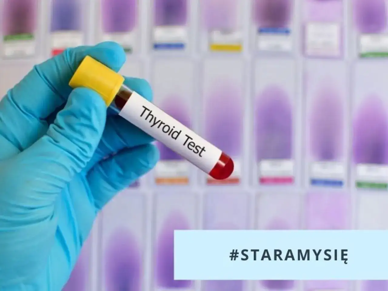 Rękawiczka trzyma probówkę z krwią do badania tarczycy. Czy wynik TSH robi się na czczo? #staramysię