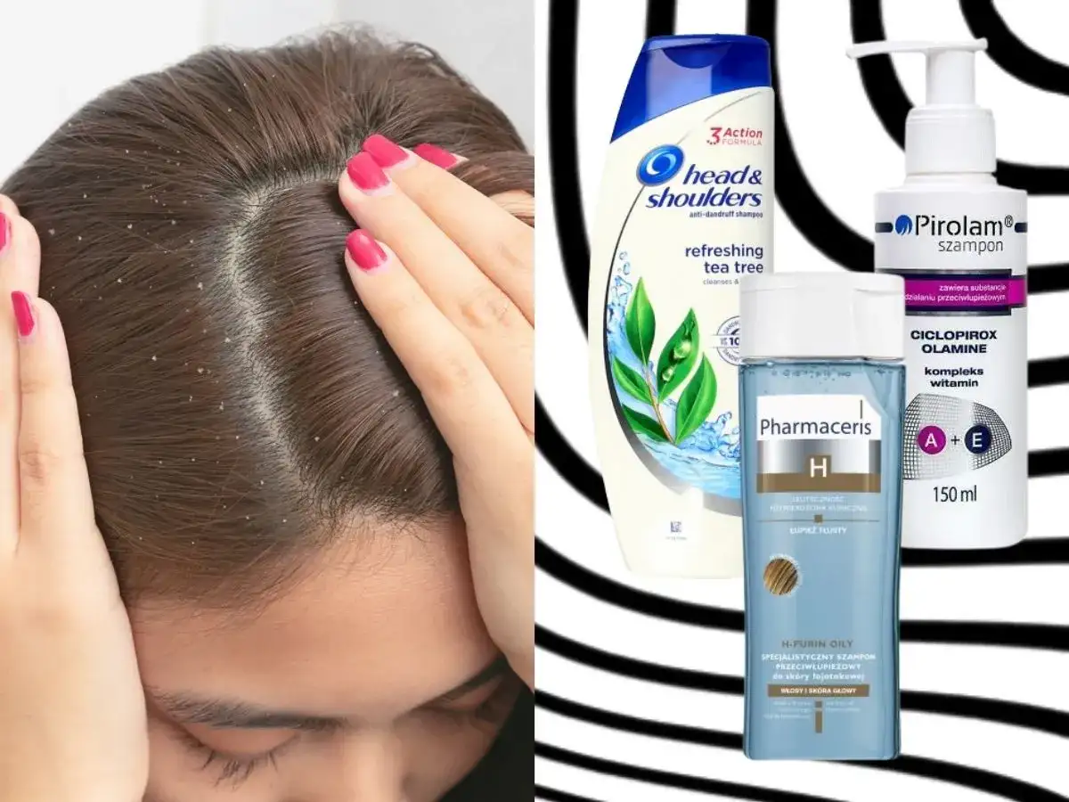 Szukasz skutecznych rozwiązań na łupież? Sprawdź pirolam opinie i porównaj z Head & Shoulders i Pharmaceris.