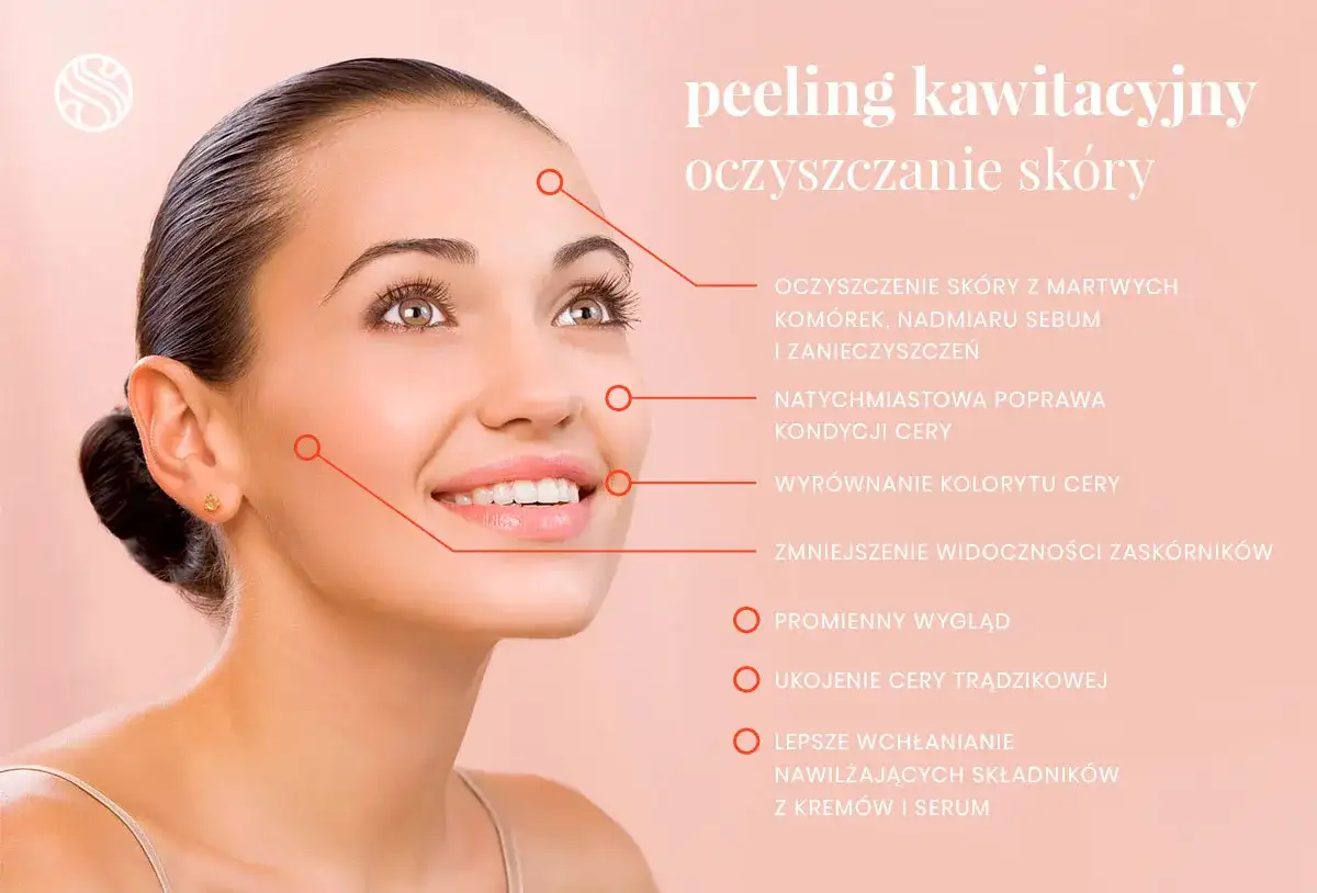 Peeling kawitacyjny: oczyszczenie, poprawa kondycji, wyrównanie kolorytu, redukcja zaskórników, promienny wygląd. Brak negatywnych efektów ubocznych.
