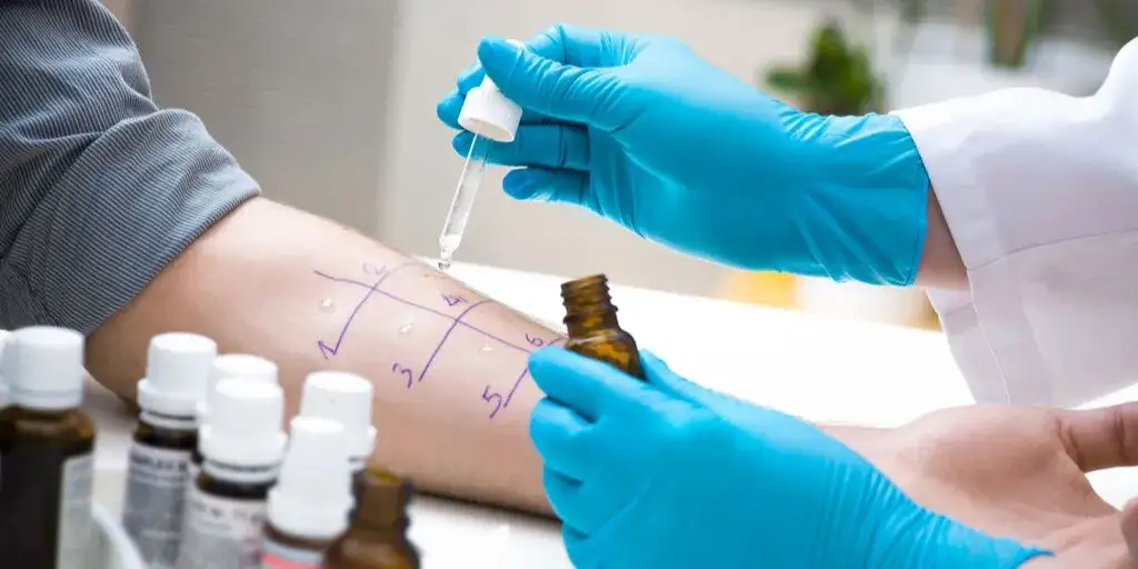 Alergia na roztocza: Objawy, których nie wolno lekceważyć