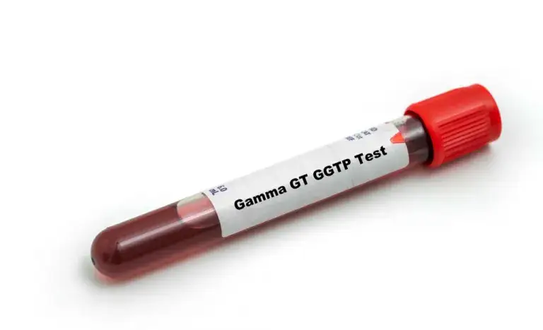 Podwyższone GGTP: Co oznacza? Przyczyny, normy i jak obniżyć