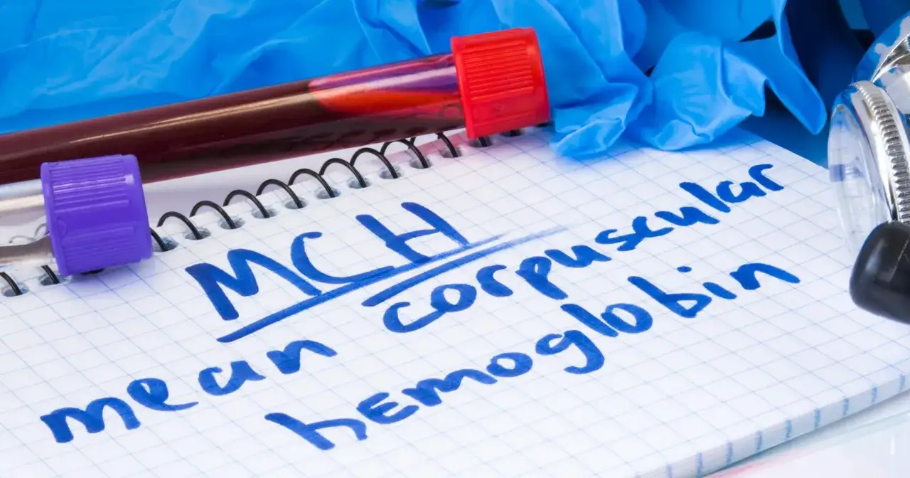 Na notatniku zapisano "MCH - mean corpuscular hemoglobin". Obok probówki z krwią, rękawiczki i stetoskop.