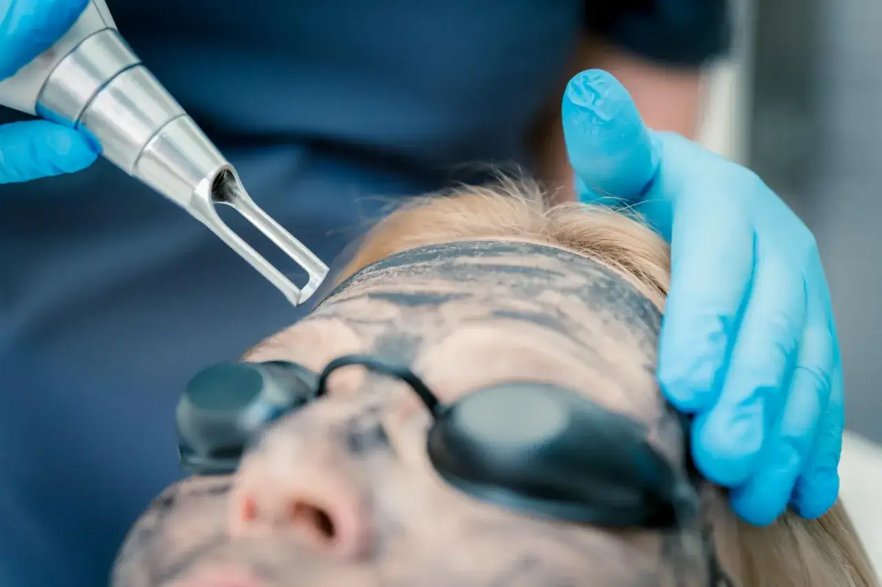 Peeling węglowy co daje: niezwykłe korzyści dla Twojej skóry