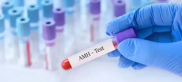 AMH co to za badanie? Klucz do płodności i interpretacji wyników
