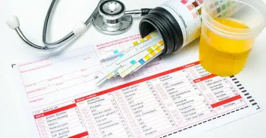 Jakie badanie moczu na nerki pomoże uniknąć poważnych problemów?