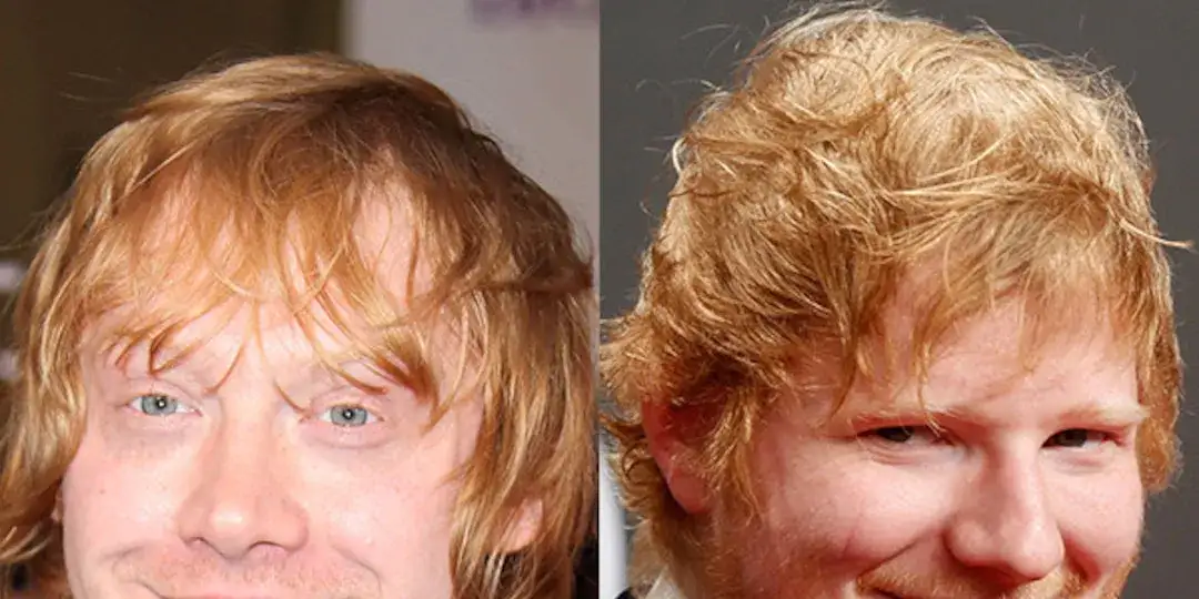 Czy Ed Sheeran grał w Harrym Potterze? Prawda o jego udziale