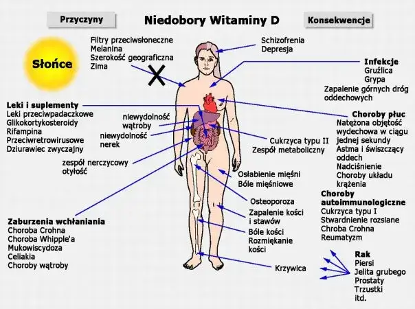 Niedobór wit D3 objawy: jak rozpoznać i uniknąć poważnych skutków