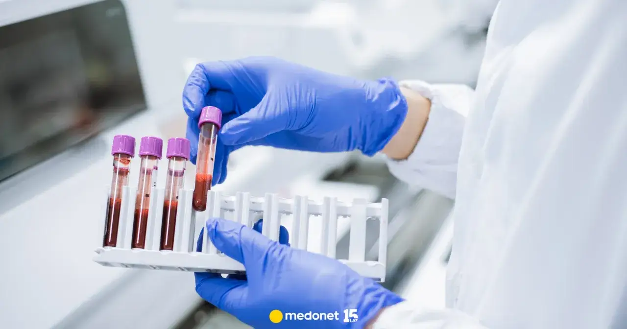 Wysoka ferrytyna: Do jakiego lekarza i co dalej? Twój przewodnik.