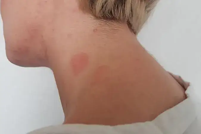 Czy Shellac uczula? Sprawdź ryzyko alergii i porównanie z Semilac