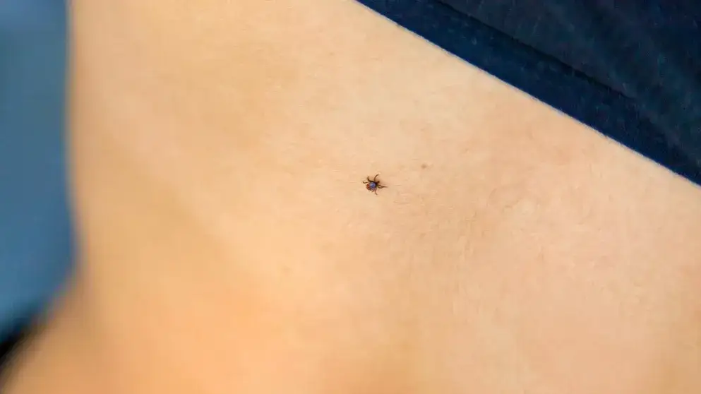 Effektive Methoden: Wie tötet man Zecken sicher und schnell?