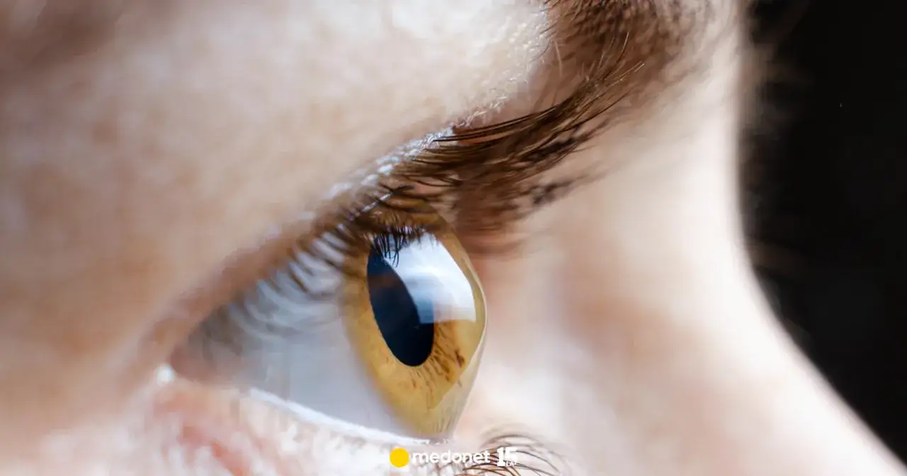 Astygmatyzm: Czym jest, objawy i skuteczne metody korekcji?