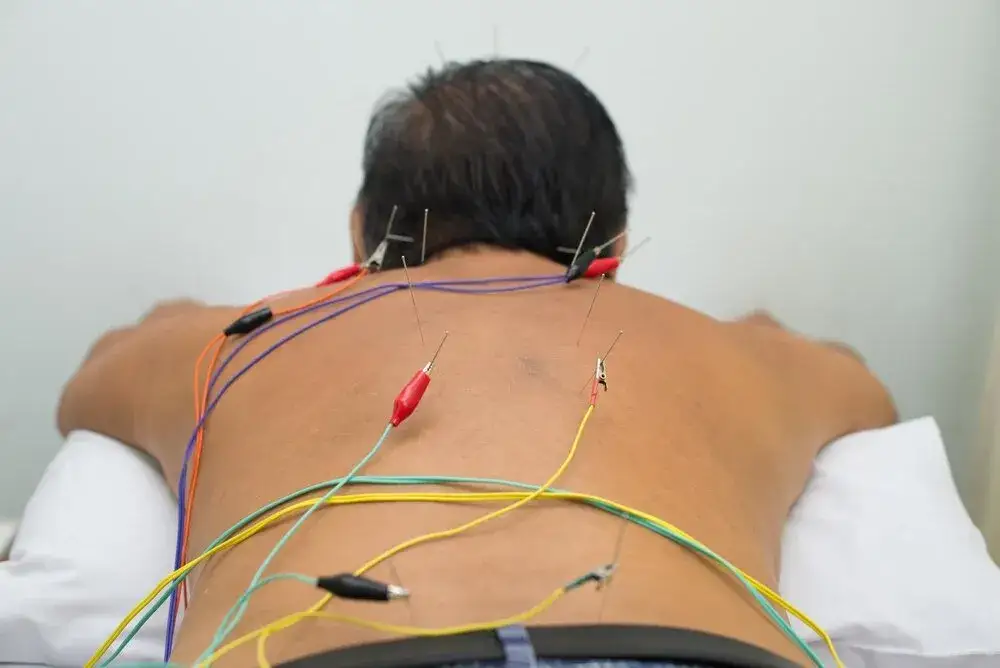 TENS: Jak prądy elektryczne leczą ból? Pełny przewodnik