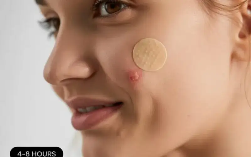 Ile trzymać maść ichtiolową na pryszczu? Ekspert radzi!