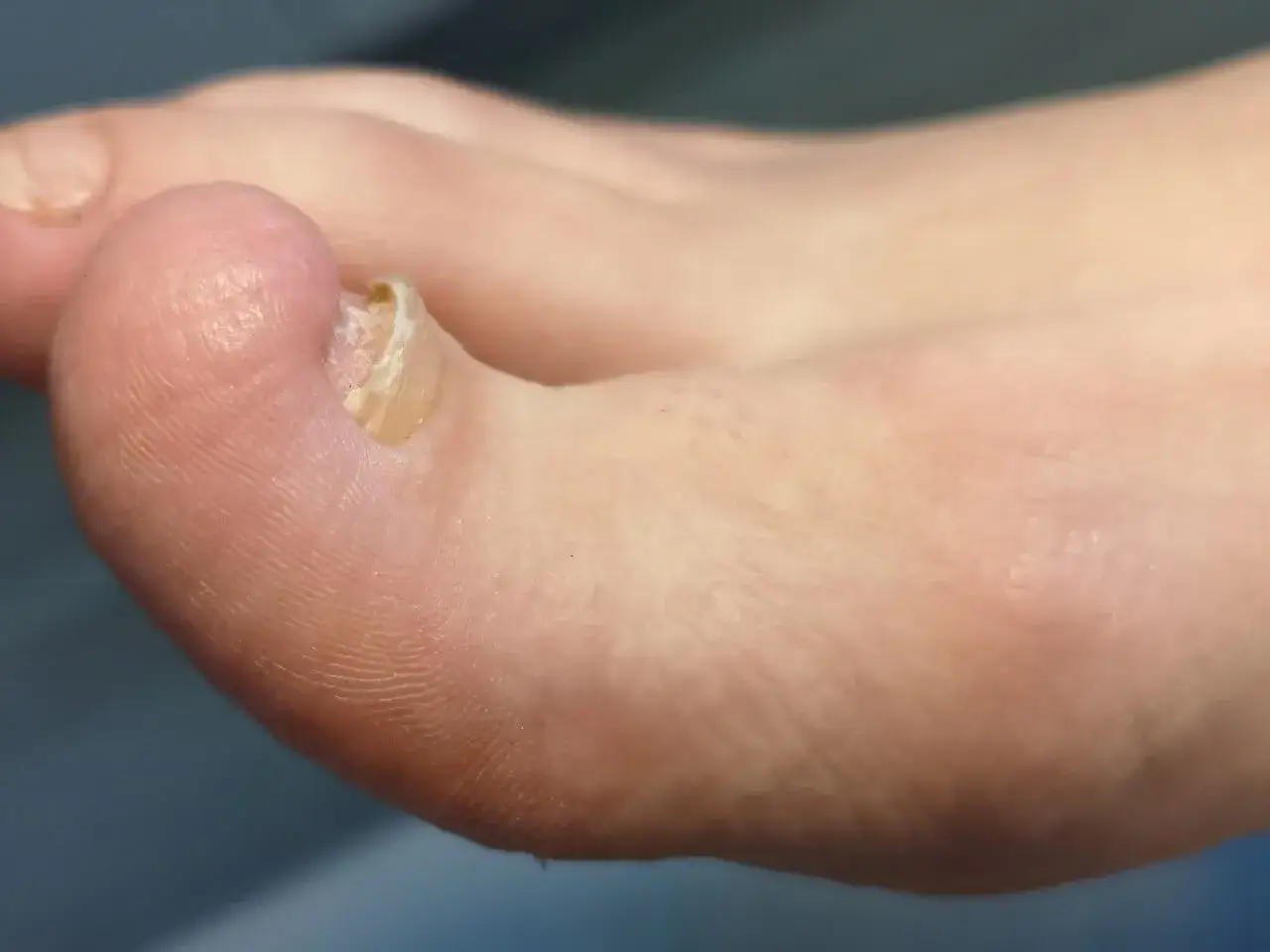 Jak długo rośnie paznokieć u nóg? Poznaj tempo wzrostu i regeneracji