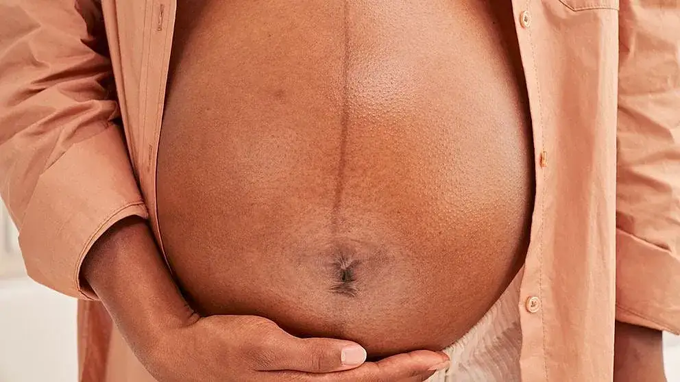 Czy skóra się rozciąga? Odkryj, co wpływa na jej elastyczność