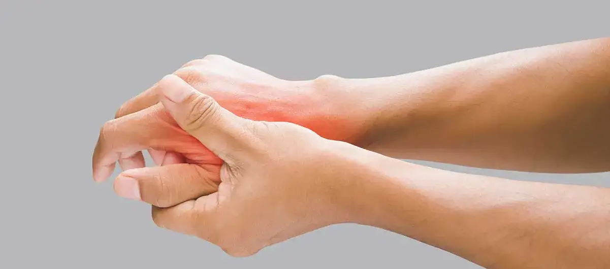 Skręcony nadgarstek: Rozpoznaj objawy, stopnie i pierwszą pomoc