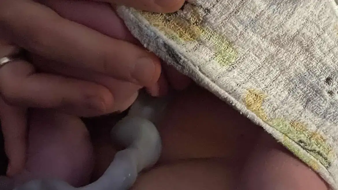 Pępowina wokół szyi na USG: co to oznacza i jakie niesie ryzyko?