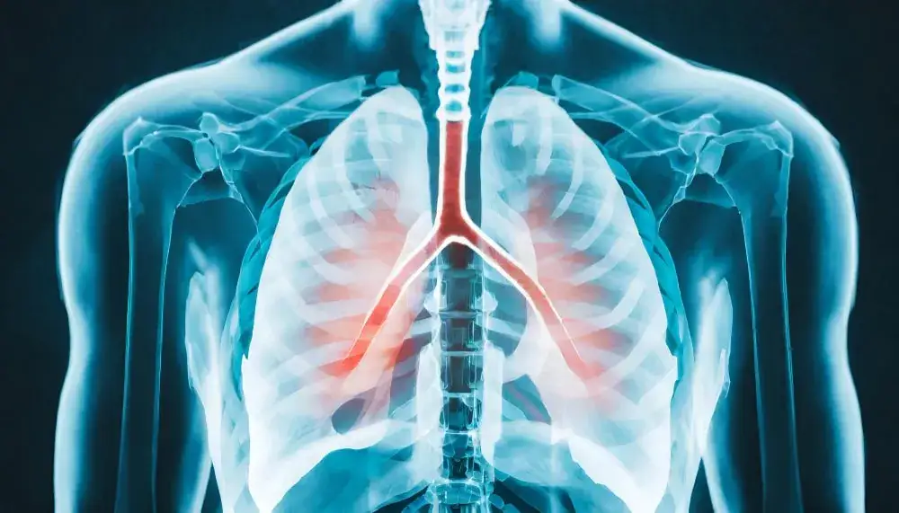 Skuteczne leki na zapalenie płuc: bezpieczne metody leczenia i kuracji