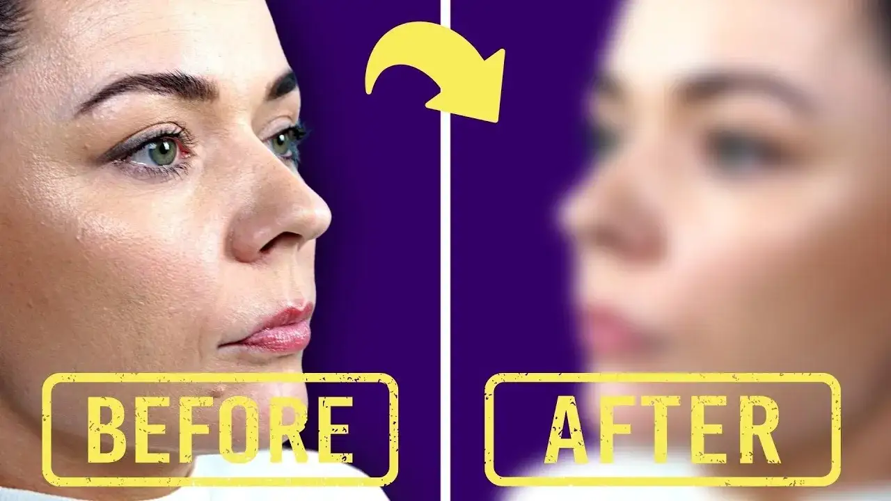 Jak spać po kwasie hialuronowym, aby uniknąć problemów ze skórą