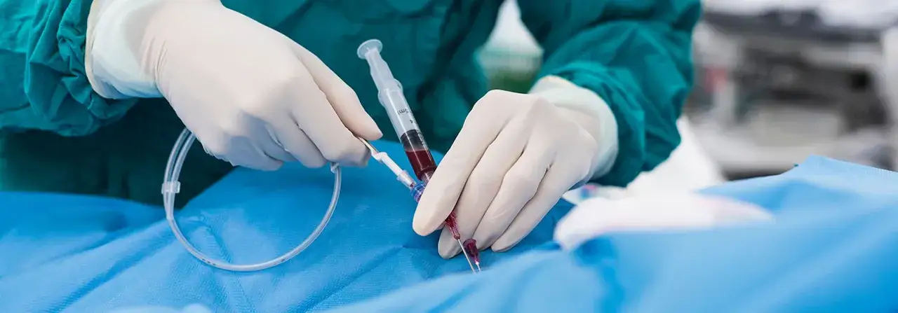 Przepychanie żył czy bezpieczne? Poznaj ryzyka i korzyści tej metody