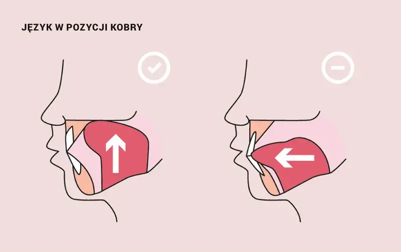 Prawidłowa pozycja języka: Jak ćwiczyć i dlaczego to ważne?