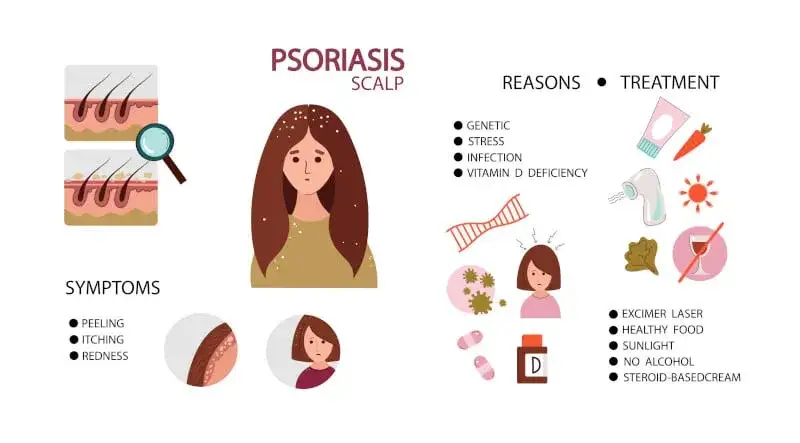 Łuszczyca głowy bez recepty: Jak skutecznie złagodzić objawy?
