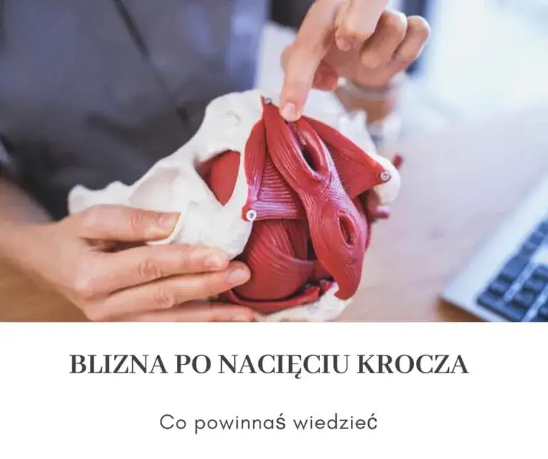 Jak dbać o krocze po porodzie: skuteczne sposoby na szybsze gojenie i komfort