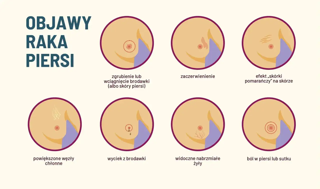 Niepokojące objawy w piersiach: rak czy łagodne zmiany?
