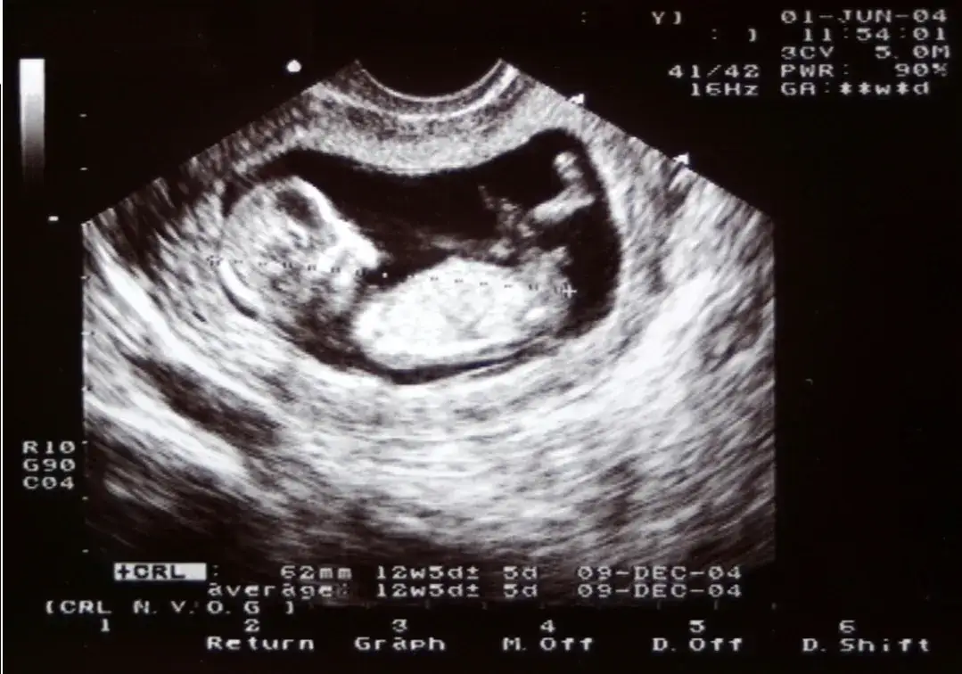 Dziwne uczucie w brzuchu jak ruchy dziecka – co to może oznaczać?