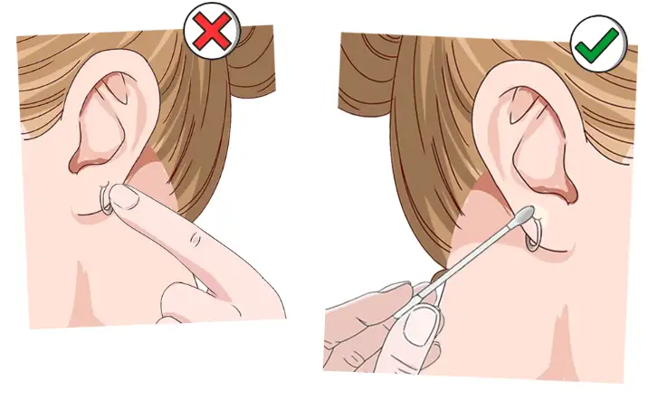 Gojenie kolczyka w uchu: Czas, etapy i pielęgnacja - Poradnik