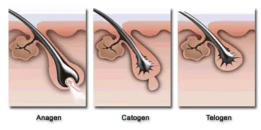 Jak działa depilacja laserowa? Mechanizm, efekty i bezpieczeństwo