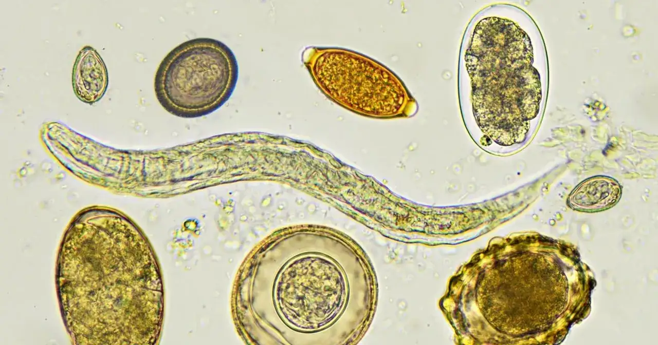 Jakie badania na pasożyty u dziecka? Kluczowe informacje i testy