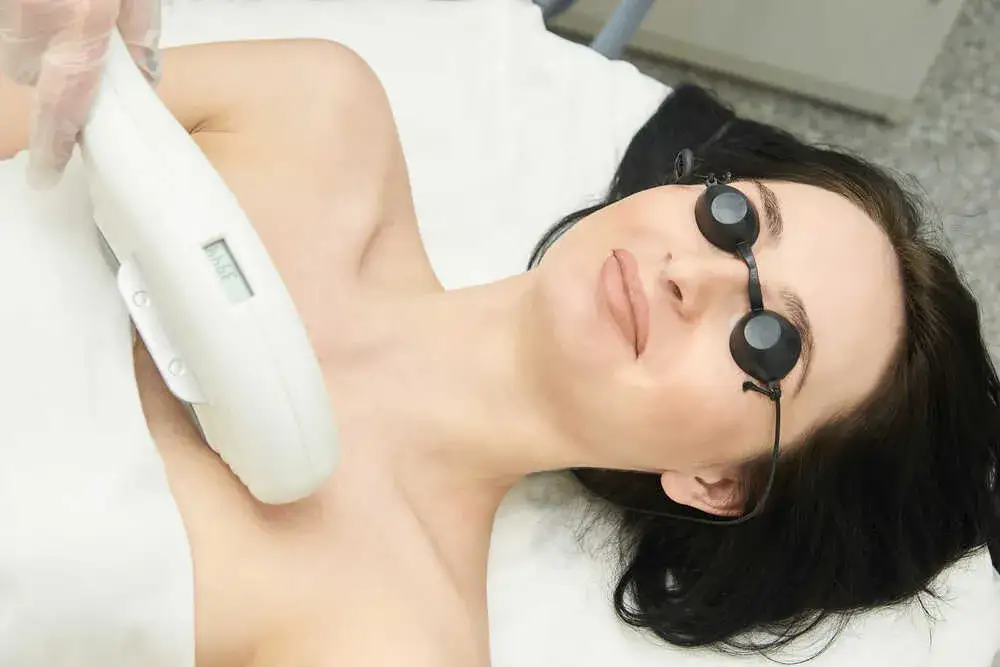 Depilacja laserowa: Ile sesji dla trwałej gładkości? Ekspert radzi.