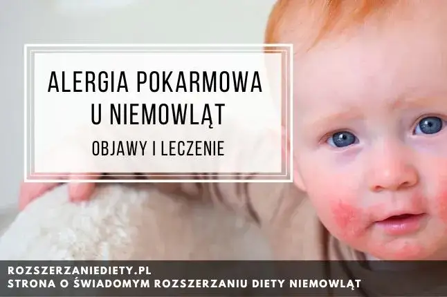 Alergia pokarmowa: objawy. Jak rozpoznać i kiedy działać?