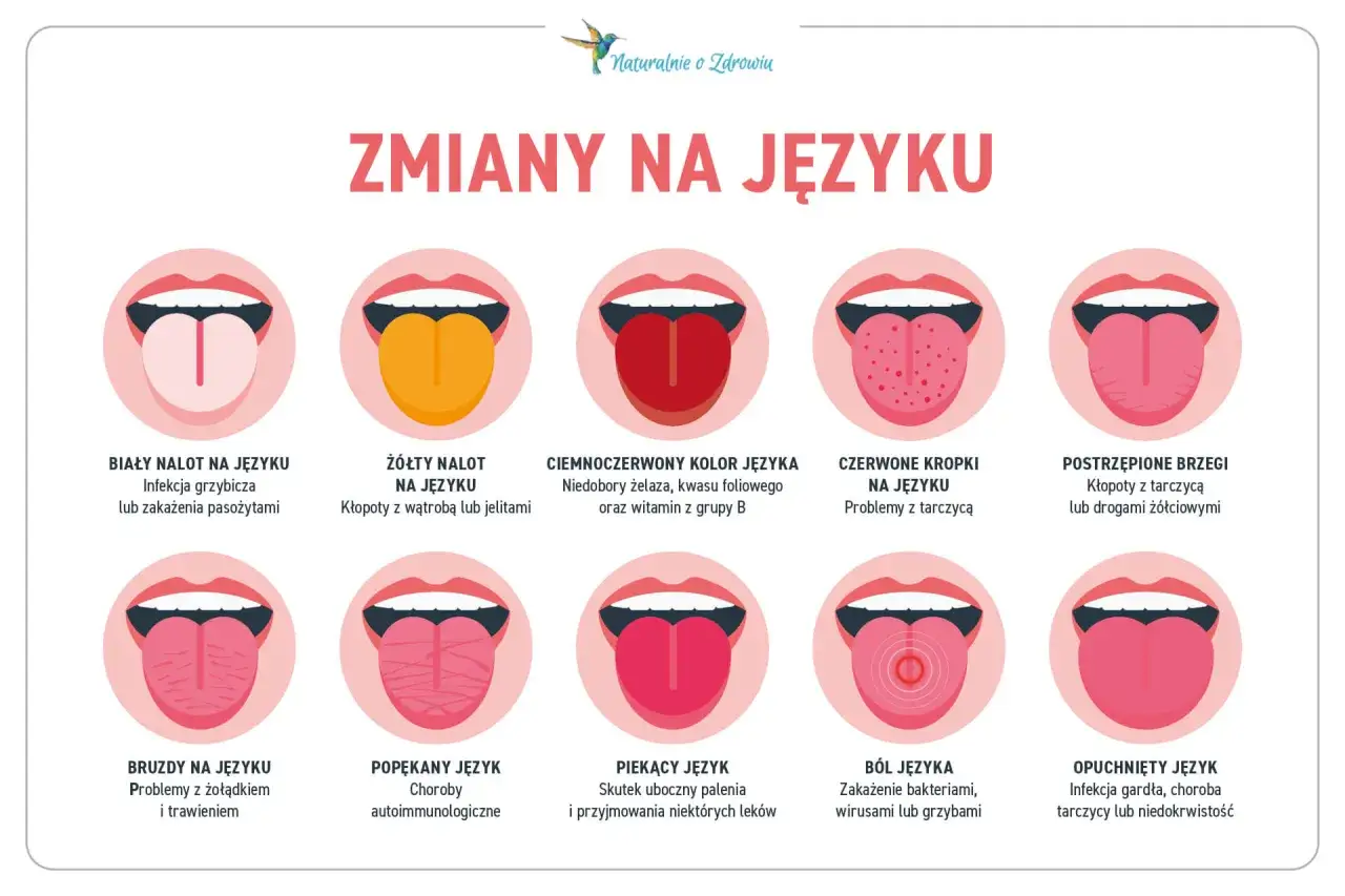 Skuteczne sposoby na pryszcz na języku – jak się pozbyć bólu i dyskomfortu