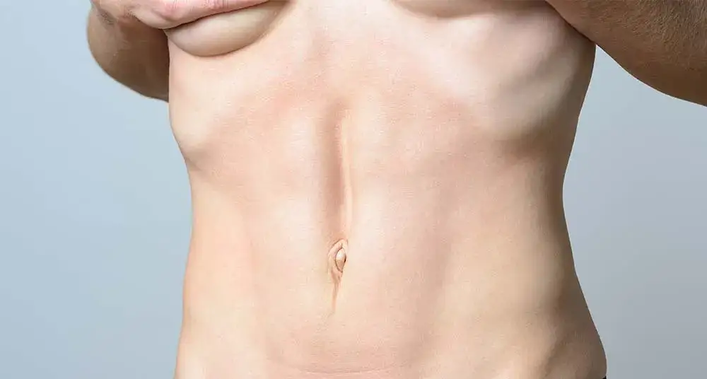 Przepuklina kresy białej: 5 objawów, które musisz znać