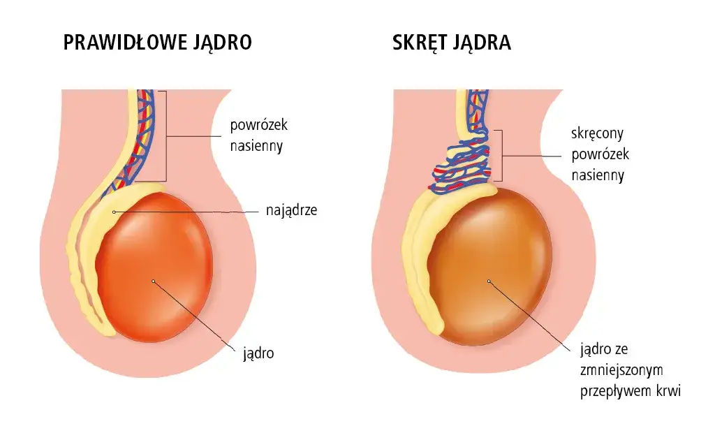 Ból jądra: Jaki lekarz? Kiedy liczy się każda minuta?