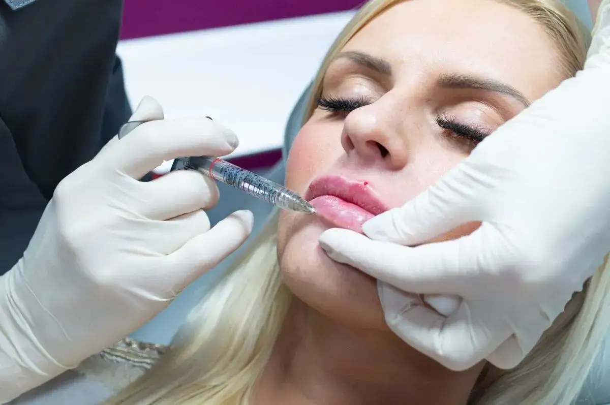 Powiększanie ust 0,5 ml: Koszt, efekty i czy to opcja dla Ciebie?