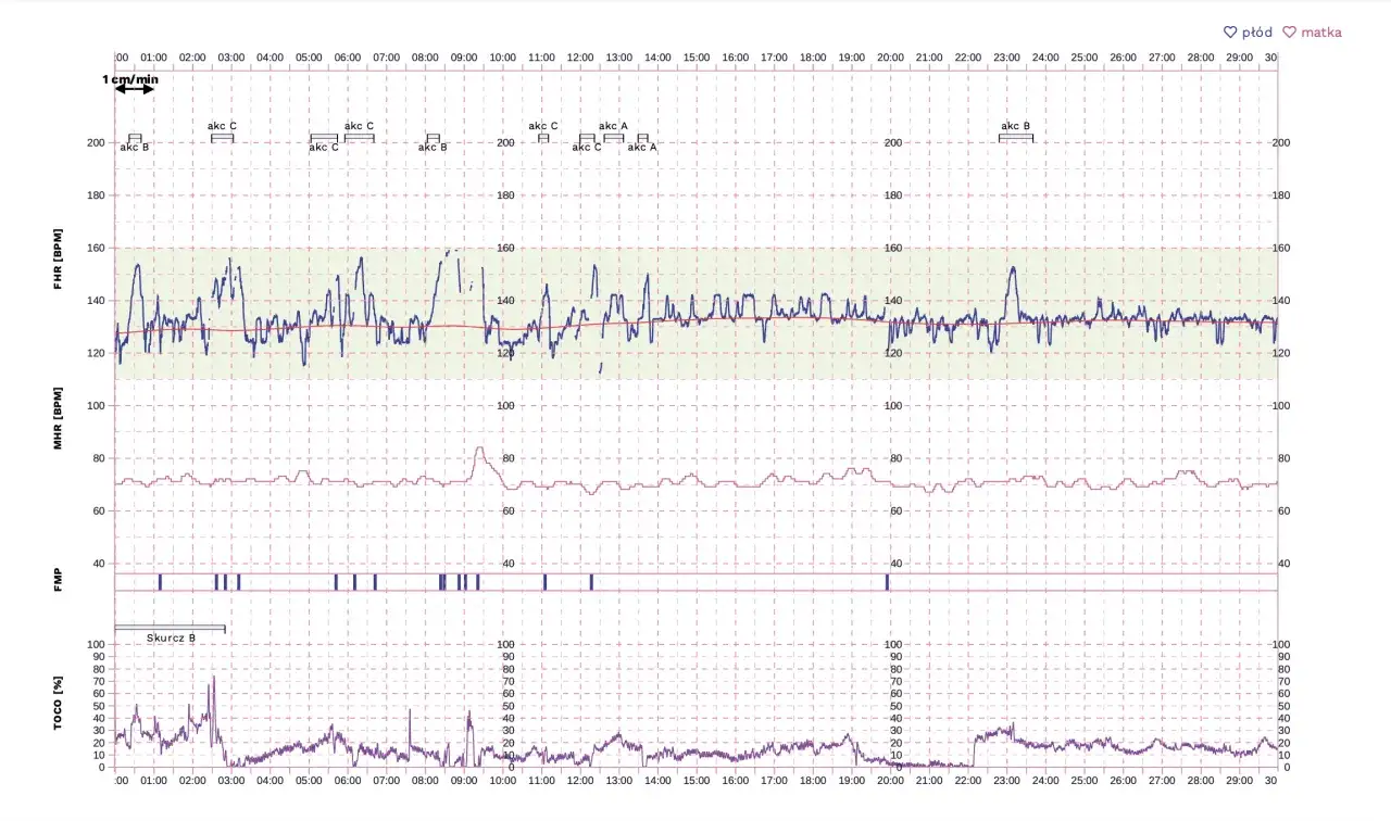 Co ile skurcze do porodu? Zrozum, kiedy zaczyna się prawdziwy ból