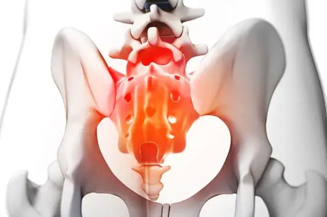 Jakie leki na ból kości ogonowej mogą przynieść ulgę w cierpieniu