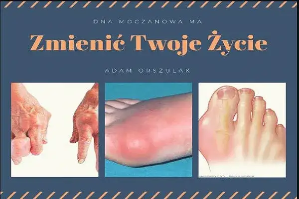 Dna moczanowa: Jaki lekarz pomoże? Skuteczna ścieżka leczenia