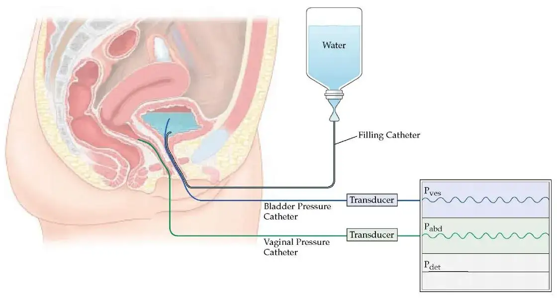 Badanie urodynamiczne w Polsce: Gdzie i jak je wykonać? NFZ czy prywatnie?