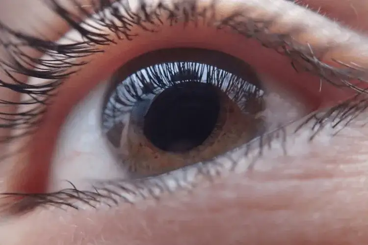 Co to jest jaskra i jak może zagrażać twojemu wzrokowi
