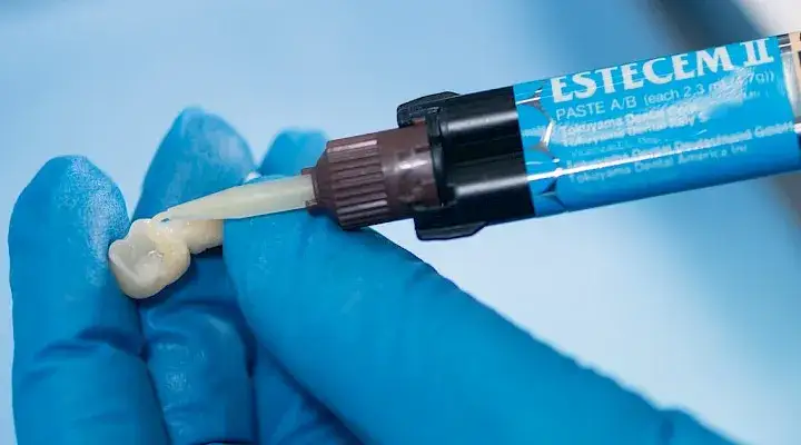 Ile schnie cement dentystyczny? Poznaj czasy schnięcia i czynniki wpływające