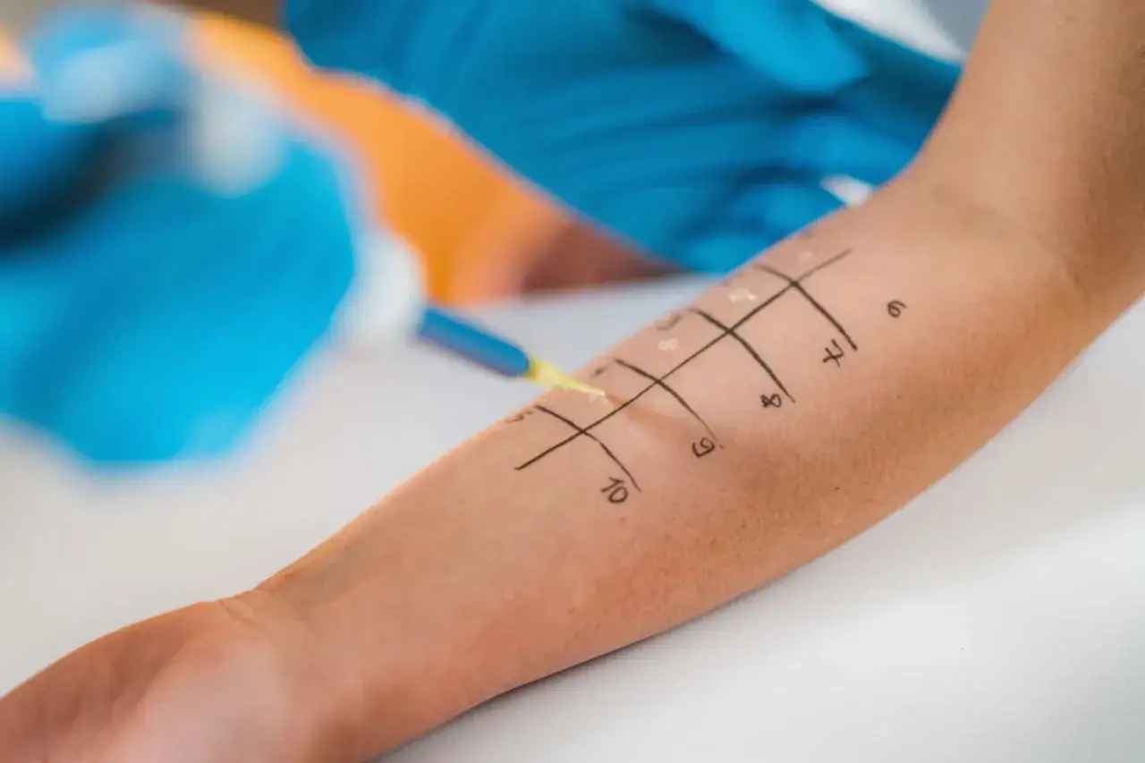 Czy jagua uczula? Dowiedz się, jak unikać alergicznych reakcji