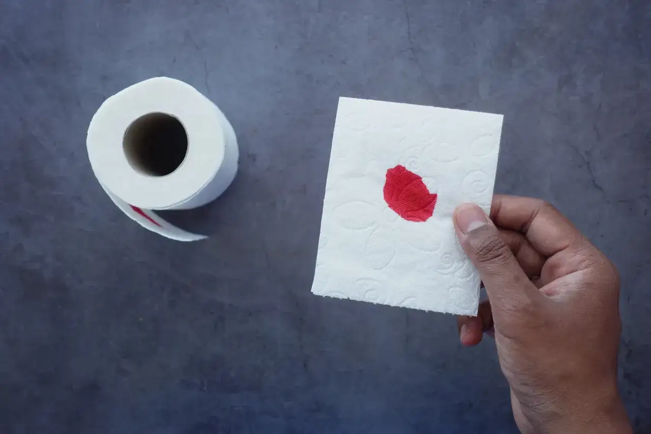 Dłoń trzyma chusteczkę z krwią, obok rolka papieru. Może to być objaw hemoroidów lub raka odbytu.